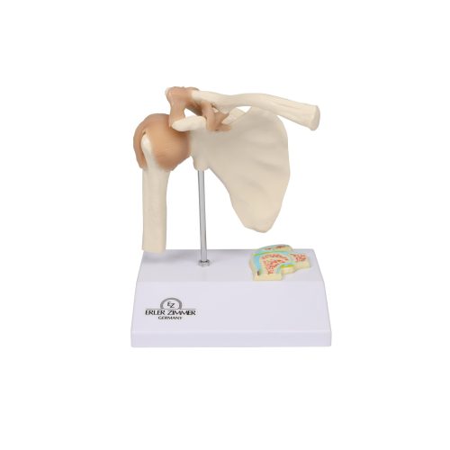Miniatűr vállízület keresztmetszettel
