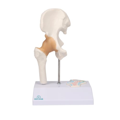 Miniatűr csípőízület keresztmetszettel