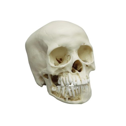 Gyermekkoponya, 12 éves