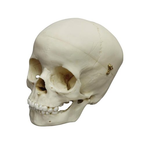 Gyermekkoponya, 5 éves