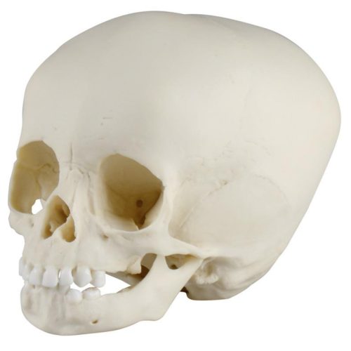 Gyermekkoponya, 15 hónapos