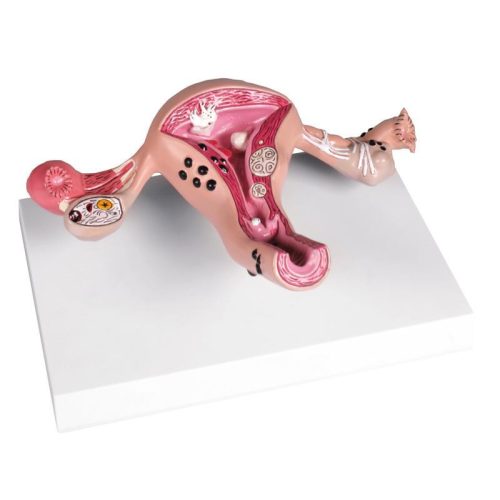 Méh betegségekkel