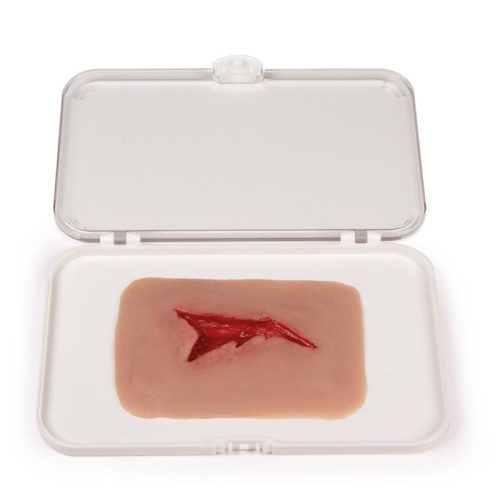 Sebmoulage sebzés