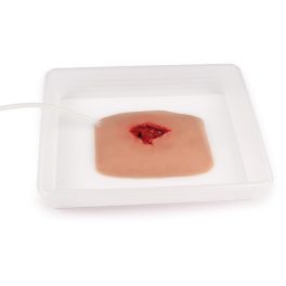 Sebmoulage sebkötözés