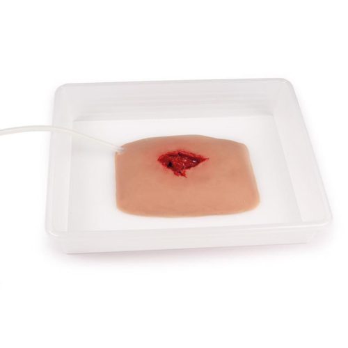 Sebmoulage sebkötözés
