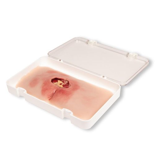 Sebmoulage sacral decubitus, megtisztítva